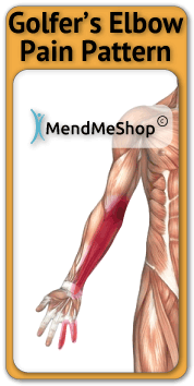golfers elbow typical pain map