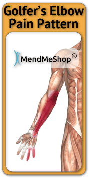 Pitchers Elbow, Wrist, Forearm pain pattern