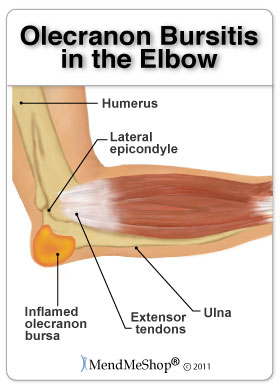 Olecranon Bursa Anatomy