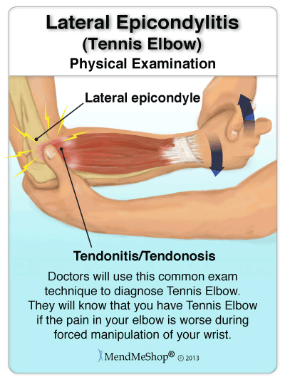 If your elbow is tender and you feel pain when pressure is applied you may have Tennis Elbow